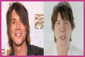 John Rzeznik Facelift | Goo Goo Dolls Frontman Plastic Surgery Before And After