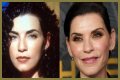 Julianna Margulies Doesn’t Look Natural After Plastic Surgery!